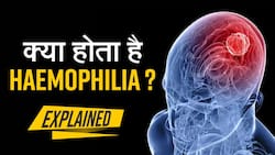 Hameophilia Symptoms: हीमोफीलिया क्या हैं? यह बच्चों को कैसे करता है प्रभावित?