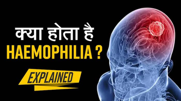 Hameophilia Symptoms: हीमोफीलिया क्या हैं? यह बच्चों को कैसे करता है प्रभावित?