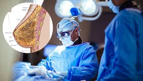 2.7Kg Removed From Woman's Breast: 3 Reasons That Can Cause Breast Enlargement