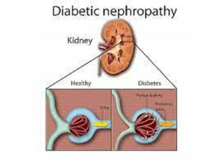 Blood sugar control and kidney health