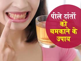 पीले दांतों को चमकाने के घरेलू उपाय, नमक से लेकर नीम जैसी साधारण चीजें आएंगी काम पीले दांतों को चमकाने के घरेलू उपाय, नमक से लेकर नीम जैसी साधारण चीजें आएंगी काम
