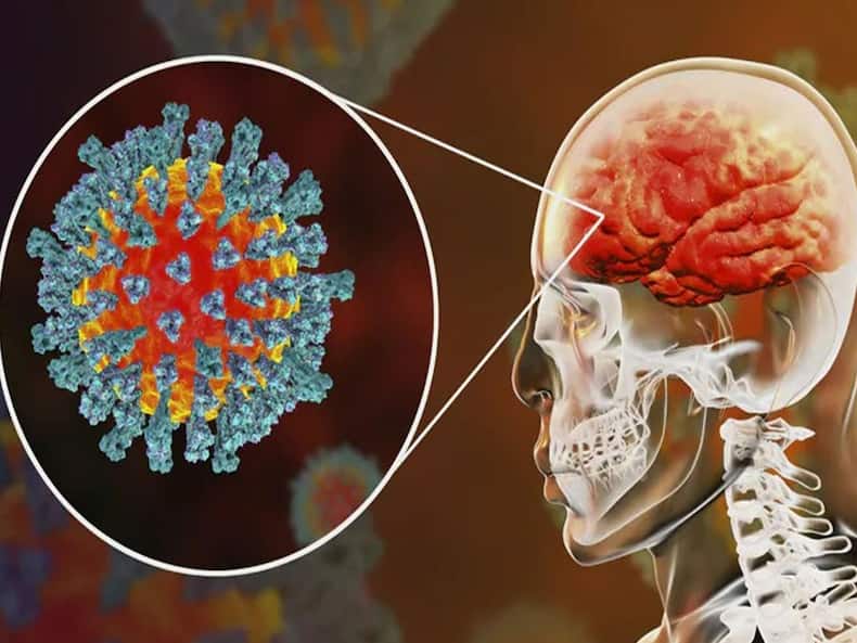 COVID Infection Can Shrink Your Brain: Eat These Foods For Healthy Brain Cells