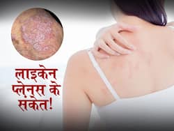 Skin Diseases: इस बीमारी में स्किन का रंग हो जाता है बैंगनी, शुरू में होते हैं ऐसे लक्षण