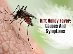 Rift Valley Fever Spreading Fast In Kashmir Through Mosquitoes: WHO Lists Down Symptoms, Check If You Have Them