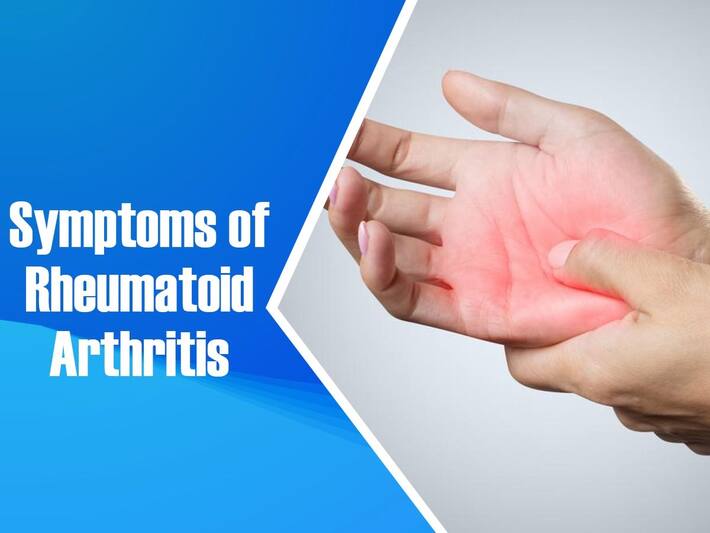 Foods For Rheumatoid Arthritis: Best Diet To Manage This Autoimmune ...