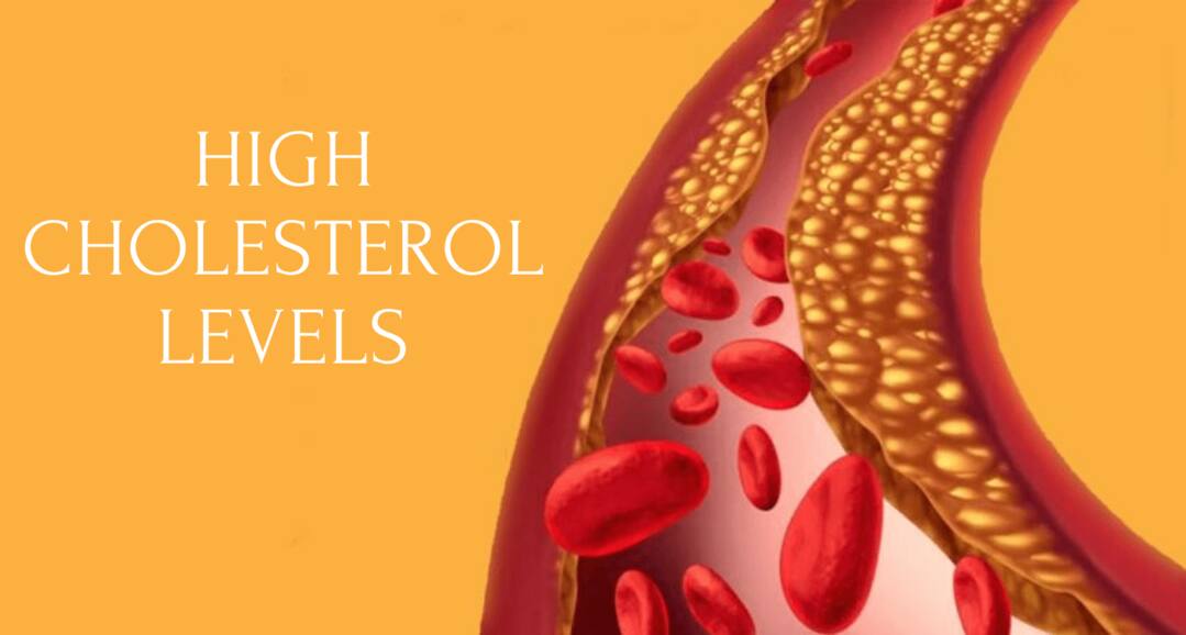 High Cholesterol Levels To Hypertension: 3 Health Conditions That Make You Prone To Heart Attack