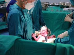 Five Things You May Not Know About Having a C-Section