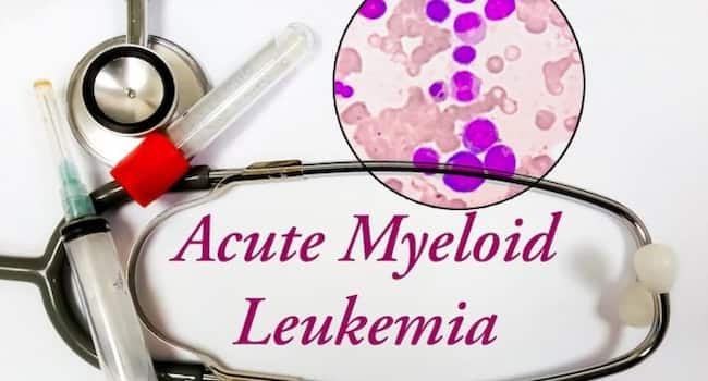 chronic-myeloid-leukaemia