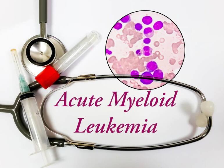 Is Blood Cancer Curable? Know The Truth About It