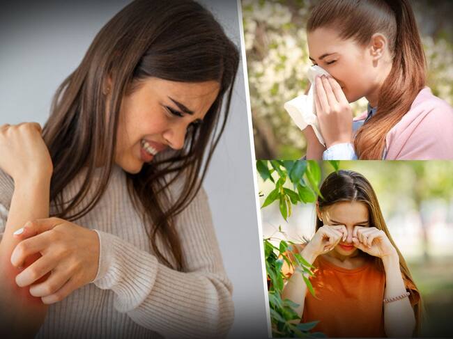 allergies