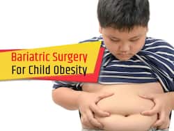 Childhood Obesity: Bariatric Surgery Is A Boon For Obese Patients
