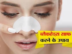 नाक पर दिखनेवाले ब्लैकहेड्स ने छीन ली है चेहरे की खूबसूरती, क्लियर स्किन के लिए आज़माएं ये 2 उपाय