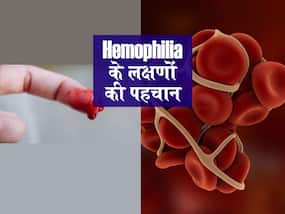 World Hemophilia Day 2022: ऐसा रोग जिसमें बहता खून बंद ही नहीं होता, जानें हीमोफीलिया के किन लक्षणों पर नजर रखना है जरूरी