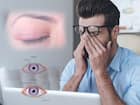 पलकों की सूजन (Blepharitis)