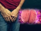 गोनोरिया (Gonorrhoea)