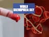 Living With Haemophilia? Here's Everything You Need to Know