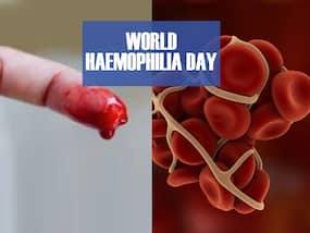 Living with Haemophilia: Everything You Need to Know