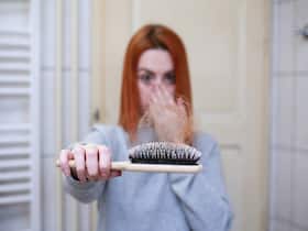 Diet: A Crucial Aspect Of Your Transplanted Hair Regrowth