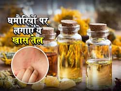 गर्मियों में घमौरियों का इलाज हैं ये 5 हर्बल ऑयल, जानें इस्तेमाल का तरीका और औषधीय गुण