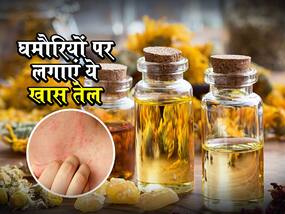 गर्मियों में घमौरियों का इलाज हैं ये 5 हर्बल ऑयल, जानें इस्तेमाल का तरीका और औषधीय गुण