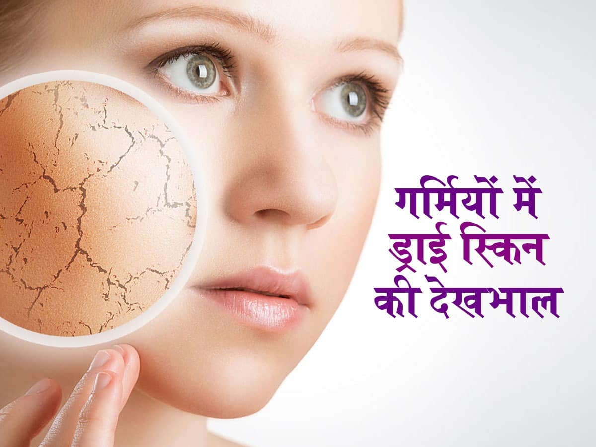 dry-skin-in-summer-home-remedies-in-hindi