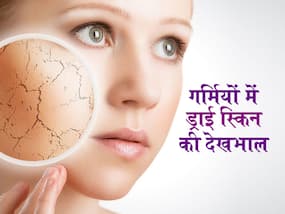 ज्यादा देर एसी में बैठने से स्किन हो जाती है ड्राई तो, अपनाएं ये 5 घरेलू उपाय