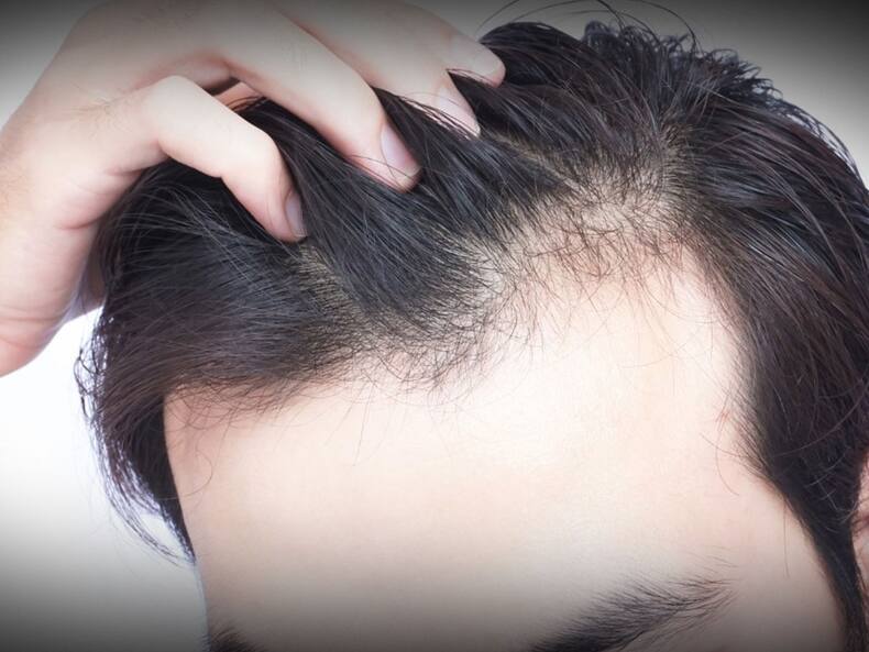 बालों के लिए इन 5 तरह से इस्तेमाल करें कलौंजी