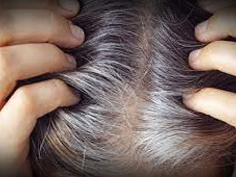 बालों के लिए इन 5 तरह से इस्तेमाल करें कलौंजी