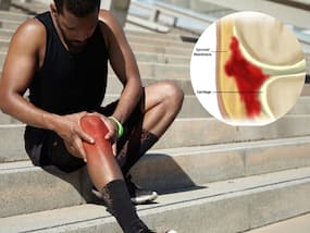 Bleeding In Joints A Common Symptom Of  Haemophilia: Preventing Joint Degeneration