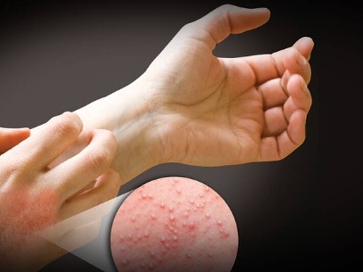 Who should not eat mango in hindi आम कब नहीं खाना चाहिए? जानें सेहत