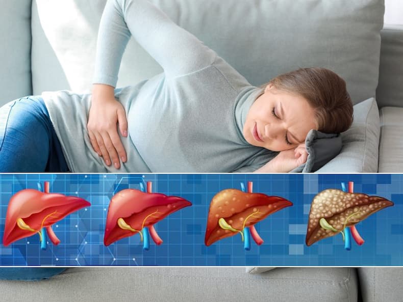 liver-disease