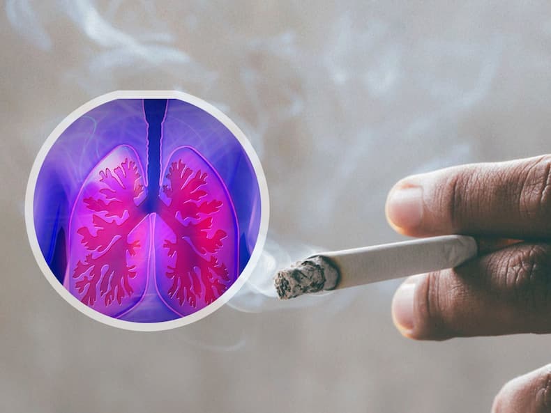 lung-cancer
