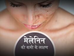 मेलेनिन की कमी के लक्षण : शरीर में मेलेनिन की कमी के कारण दिखते हैं ये 5 लक्षण, जानें उपाय