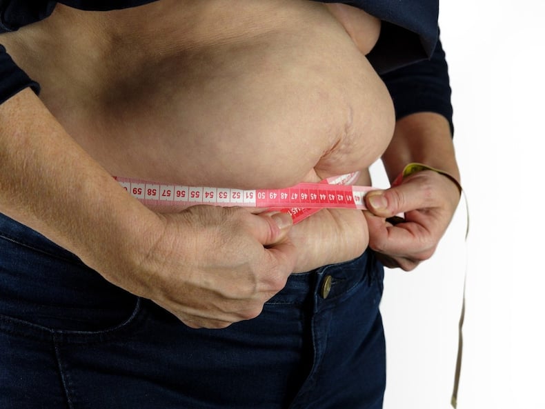 obesity