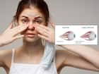 ऑप्टिक न्यूराइटिस (Optic Neuritis)