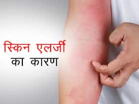 आपके घर की ये 5 चीजें हो सकती हैं स्किन एलर्जी का कारण, जानें