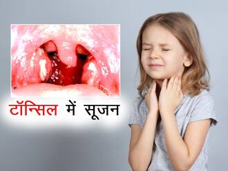 Tonsillitis - Health Tips in Hindi, Tonsillitis Health Articles in ...