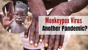 Are Indians At Risk of Monkeypox Outbreak Too? Virus Spreading Rapidly In Europe, North America Are Indians At Risk of Monkeypox Outbreak Too? Virus Spreading Rapidly In Europe, North America