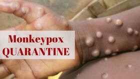 Belgium Becomes First Country To Introduce Monkeypox Quarantine As Virus Spreads To 12 Countries Belgium Becomes First Country To Introduce Monkeypox Quarantine As Virus Spreads To 12 Countries