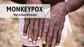 Monkeypox Not A Gay Disease, Anybody Can Contract It...: WHO Answers Vital Questions On The Virus