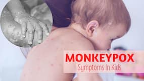 Monkeypox Symptoms In Kids: Exhaustion To Weakness, What To Watch Out For?