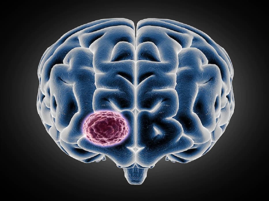 5 Possible Reasons Behind Your Constant Headache
