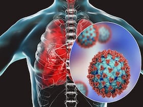 Cells Infected With COVID-19 Can Explode And Damage Internal Organs, Researchers Warn