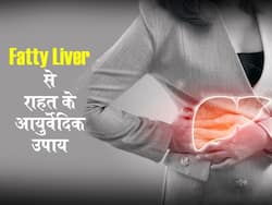 साइलेंट किलर कही जाने वाली बीमारी है फैटी लिवर डिजिज,जानें इसके लक्षणों और राहत के उपाय