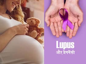 ल्यूपस की बीमारी बढ़ा सकती है जेस्टेशनल डायबिटीज का रिस्क, हेल्दी प्रेगनेंसी के लिए एक्सपर्ट्स देते हैं इस तरह की सावधानियां बरतने की सलाह