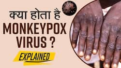 Monkeypox Virus Symptoms:कोरोना के बाद अब मंकीपॉक्स नाम के वायरस ने दी दस्तक, देखें वीडियो