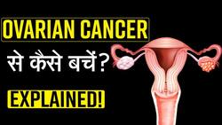 Ovarian Cancer: ओवेरियन कैंसर है घातक, डॉक्टर से जानिए इसका उपचार, Watch Video