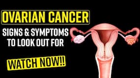 Ovarian Cancer: Early Symptoms To Look Out For- Watch Video