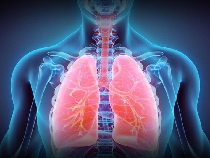 Pneumonia: How Fluid Forms Inside The Lungs And Then Damages It ...