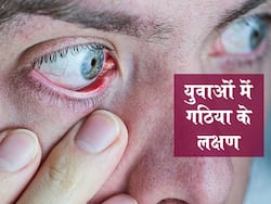 आंखों में भी दिखते हैं गठिया के लक्षण, जानें युवाओं में इसे पहचानने के 5 शुरुआती संकेत